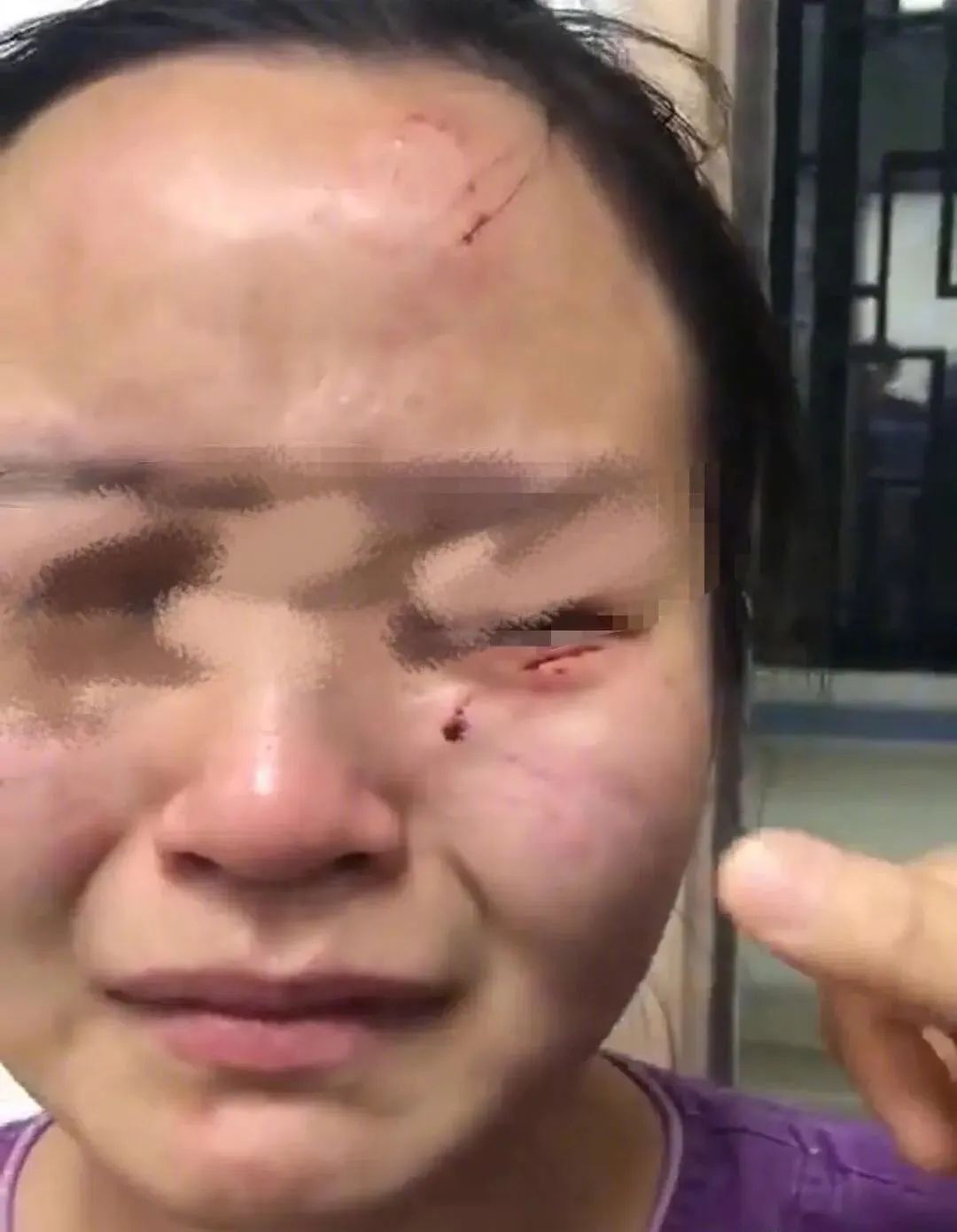 男子持水杯砸伤女同事被刑拘后续